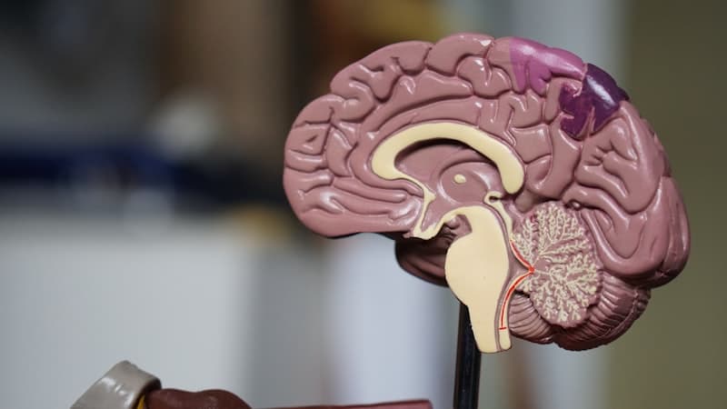 Anatomical model of the human brain